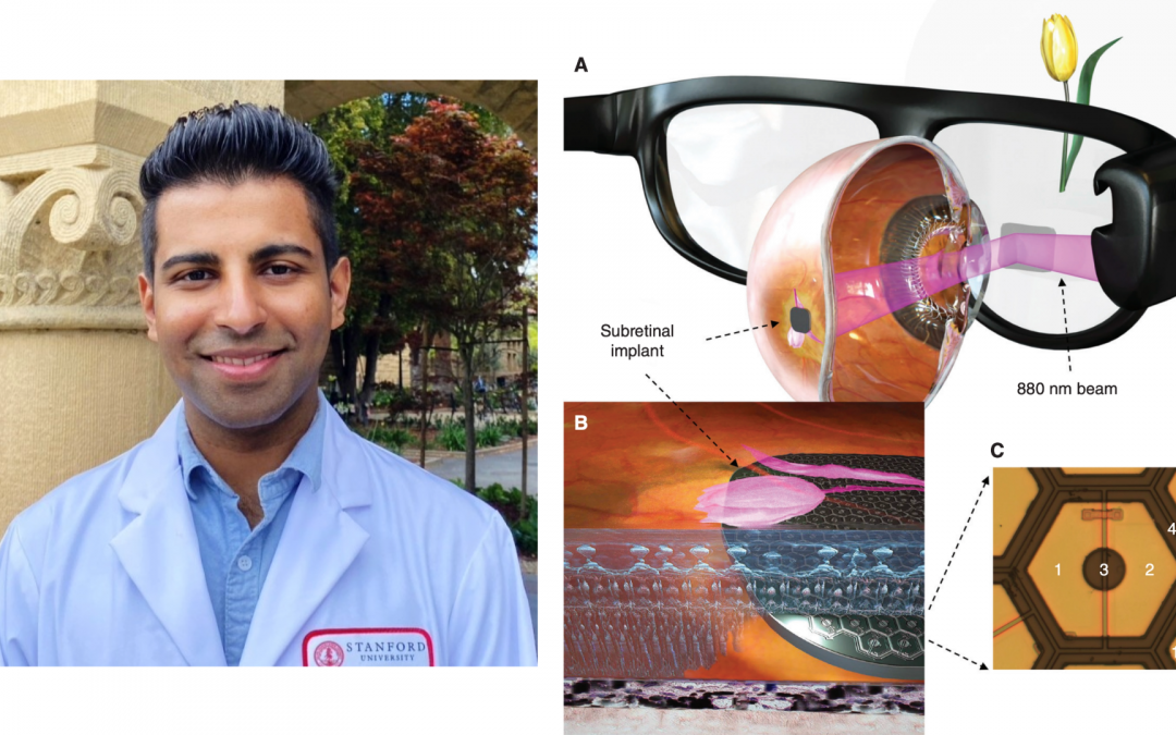 Conferencia: “Restauración de la visión en personas ciegas mediante dispositivos fotovoltaicos miniaturizados”